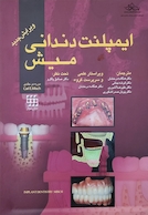 ایمپلنت دندانی میش 1 و 2